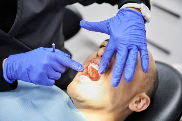 Best Emergency Treatment for Dental Infections or Abscesses in Macungie, PA